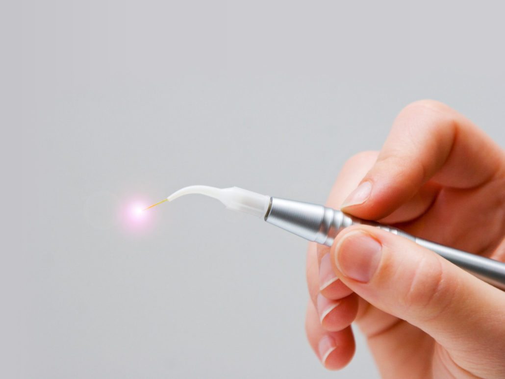 laser dentistry